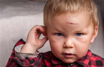 كيف يمكن ان تخفّفي من حدّة الندبات الظاهرة في جسم طفلكِ ووجهه؟
