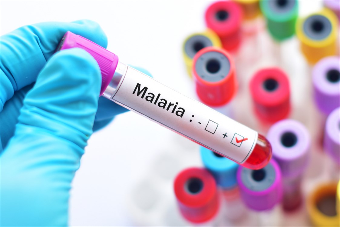  هل الملاريا معدية