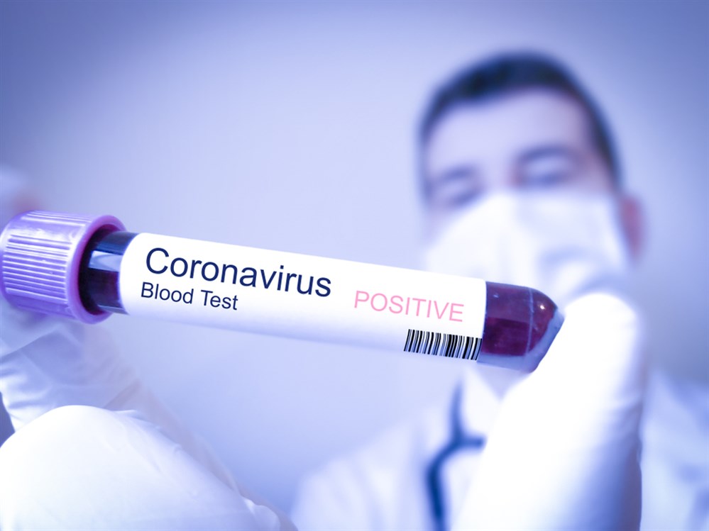 الفرق بين الاختبارات للكشف عن فيروس كورونا