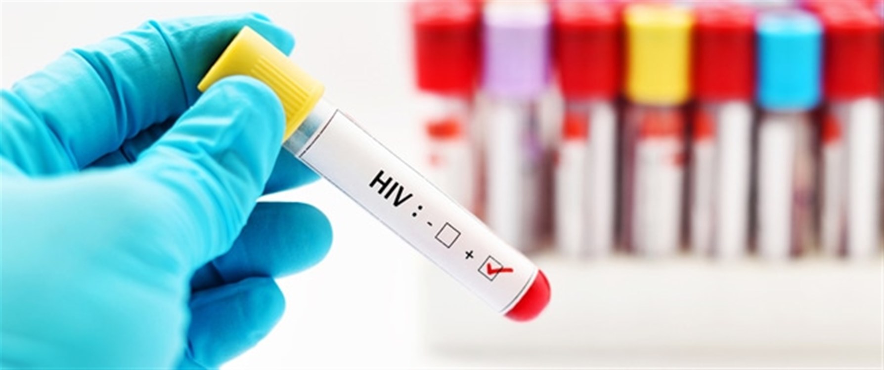 كيف ينتقل فيروس نقص المناعة المكتسب