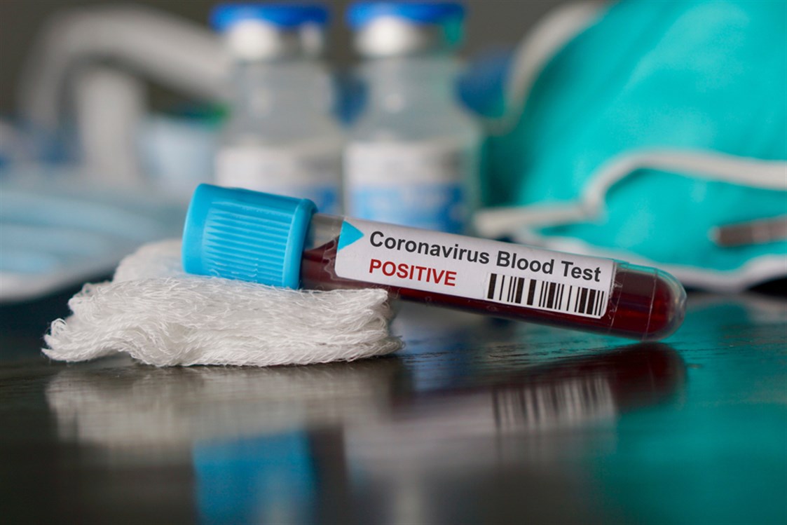  هل فيروس كورونا يصيب فئة دم معينة