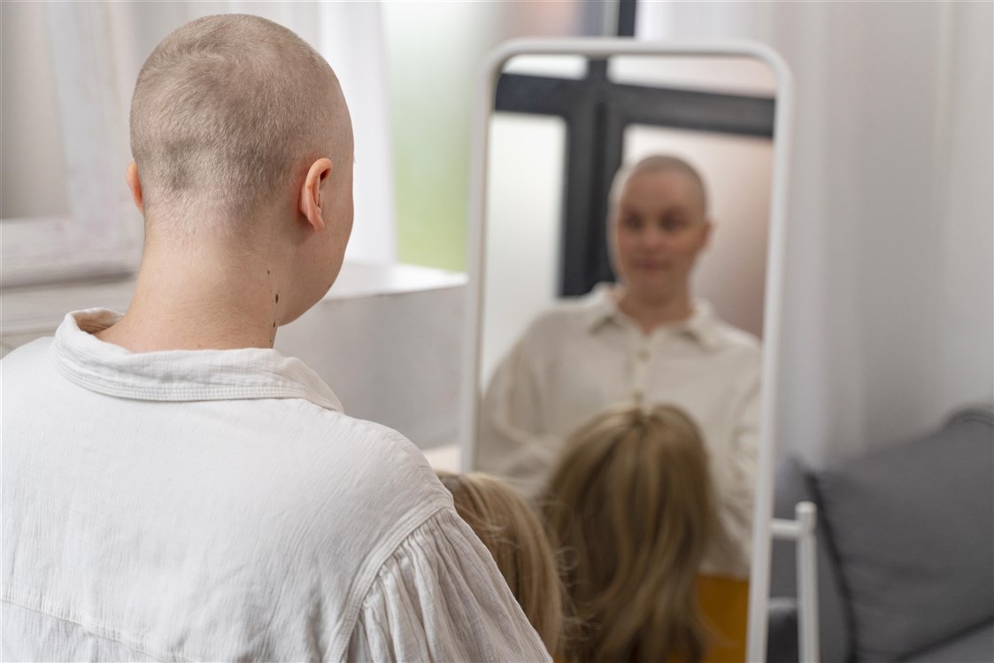 تعامل مريضة السرطان مع تساقط الشعر