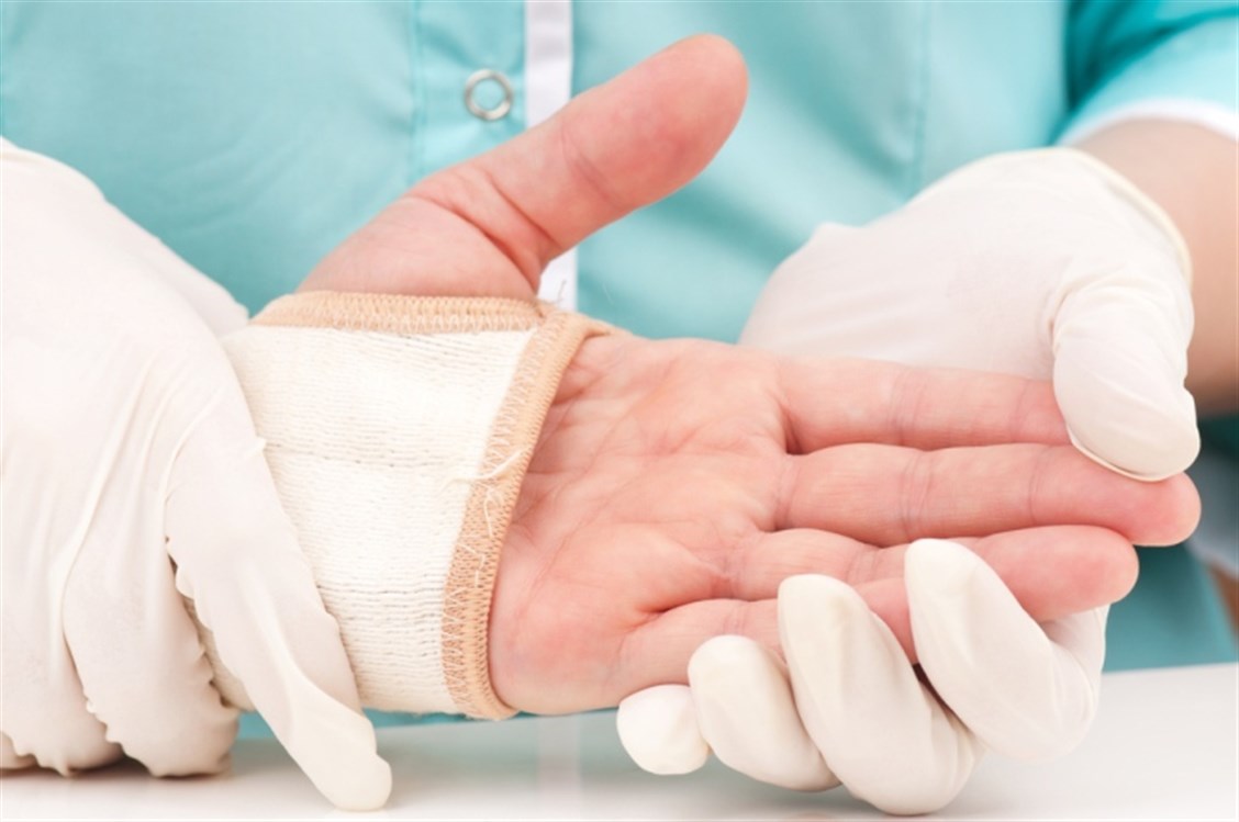 Sohati - كلّ ما يجب أن تعرفوه عن جراحة تجميل اليد!