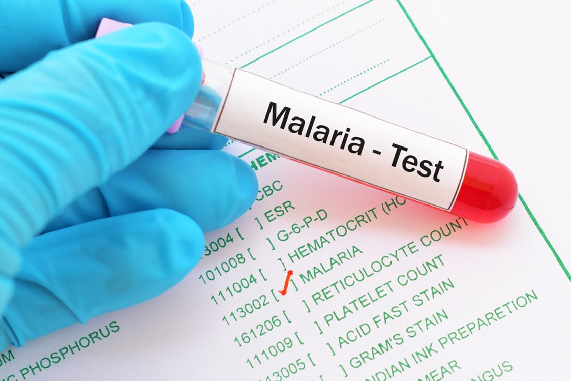  مقاومة الملاريا للأدوية