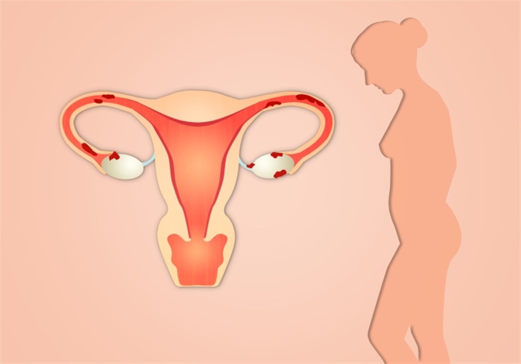 Sohati ما هي التغييرات التي تحدث في عنق الرحم أثناء الحمل المبكر