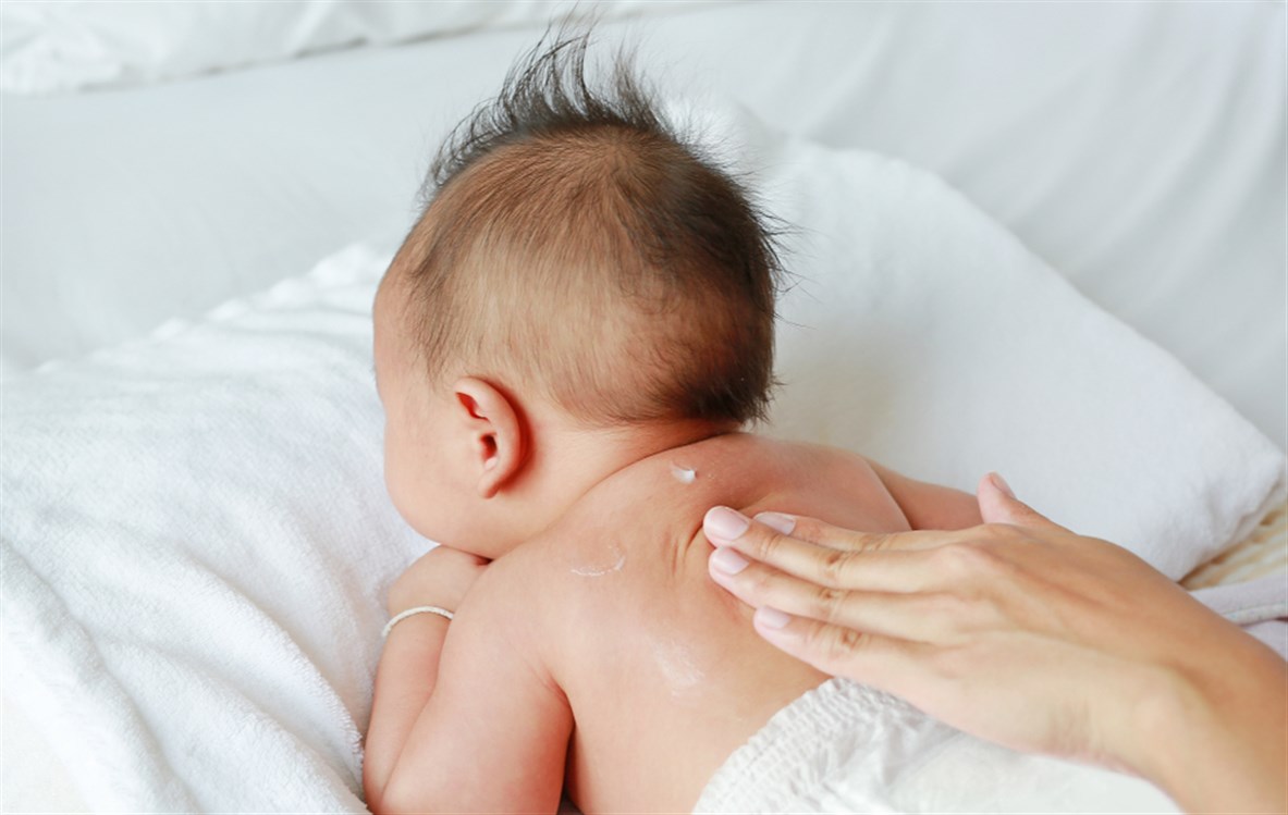 علاج جفاف بشرة الطفل