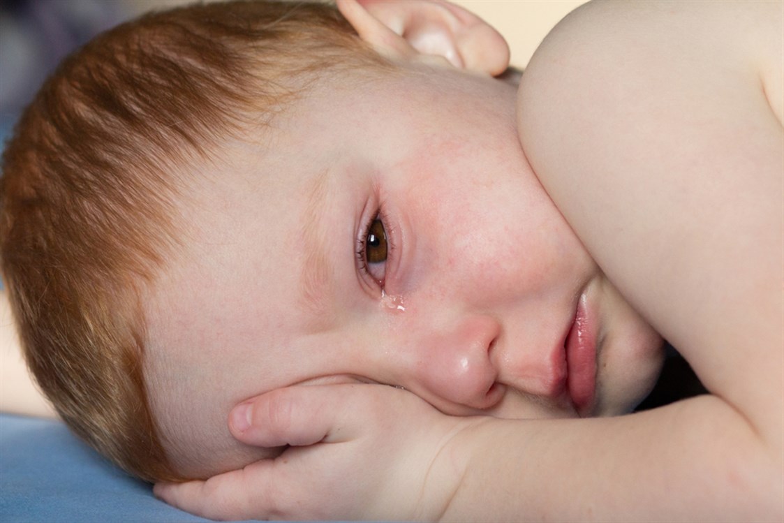 حساسية العين عند الاطفال
